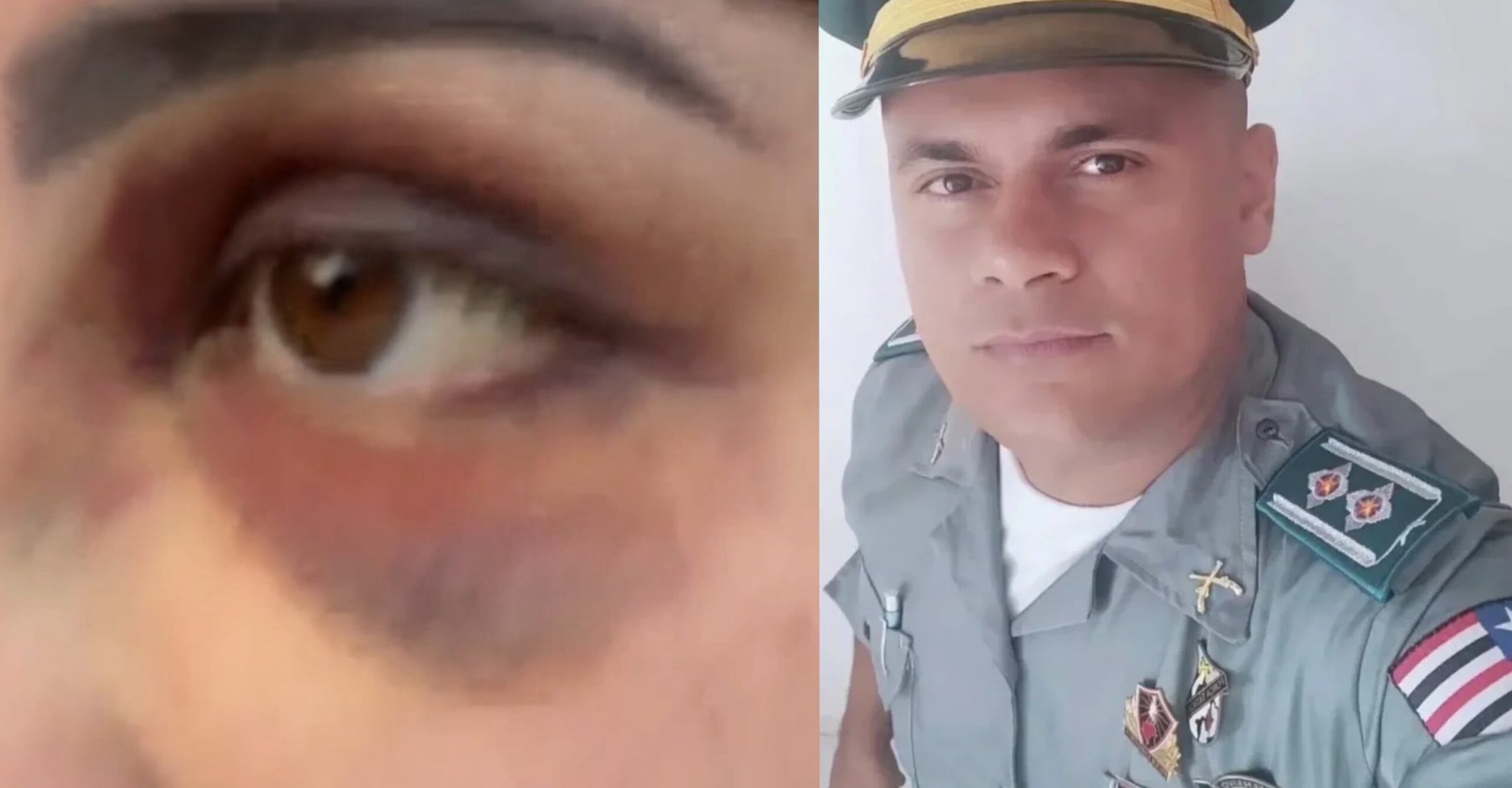 Vítima de agressões do capitão da PM-MA fala pela primeira vez “ele continuou me batendo”